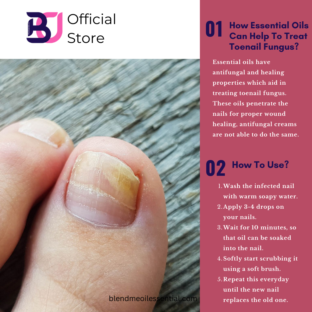 Toenail Care Essential Oil Roll On Blends 10ml