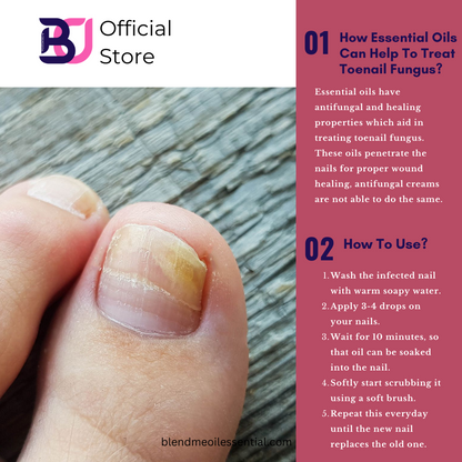 Toenail Care Essential Oil Roll On Blends 10ml