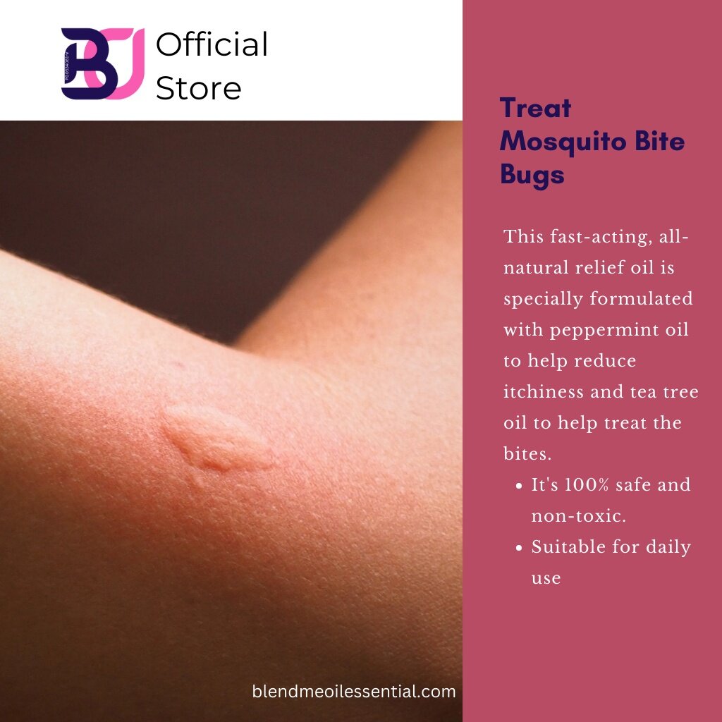 Bug Bite Relief Essential Oil Roll On Blend 10ml 蚊虫叮咬止痒